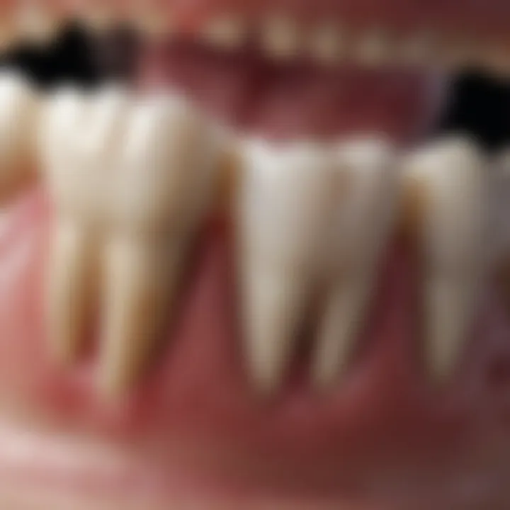 Dental stain on a tooth surface