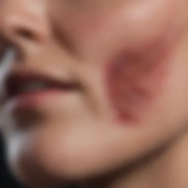 Clinical Presentation of BCC Diagram showing common clinical presentations of basal cell carcinoma on skin