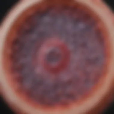 Pathological Characteristics of Signet Ring Cells Diagram illustrating the pathology of signet ring cells