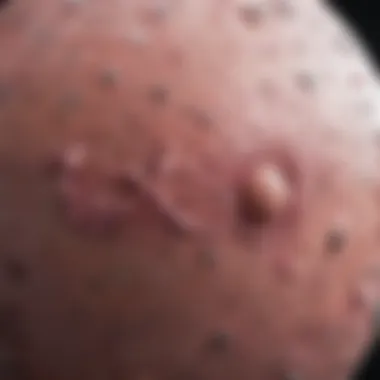 Challenges in Diagnosing Satellite Nodules Clinical implications and challenges in diagnosing satellite nodules in breast cancer