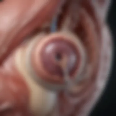 Complications After Aortic Valve Replacement Potential complications of aortic valve surgery