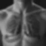 Chest X-ray showing signs of pneumonia