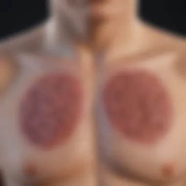 Treatment Modalities for Endobronchial Carcinoma Graphical depiction of treatment modalities for endobronchial carcinoma