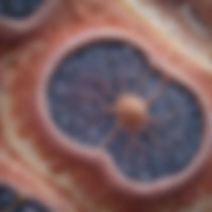 Microscopic view of osteosarcoma cells