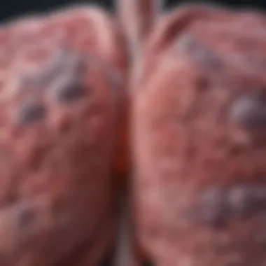 Pathological Insights into Granulomatous Lung Disease Granulomatous lung disease pathology illustration
