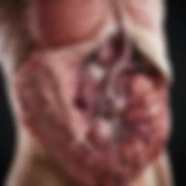 Anatomy of the Liver in Cancer Illustration depicting the liver anatomy highlighting cancerous regions.