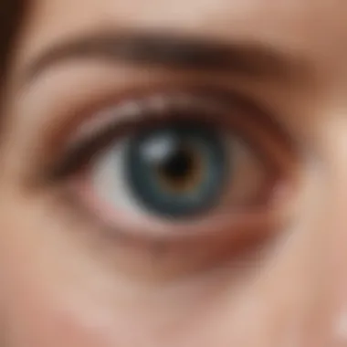 Management Strategies for Serous Retinopathy Chart depicting management strategies for serous retinopathy