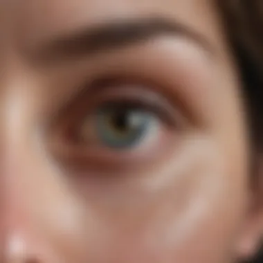 Symptoms of dry eyes in autoimmune conditions