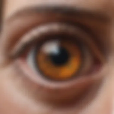 Inflammation of Ocular Structures Inflammation in the eye due to rheumatoid arthritis