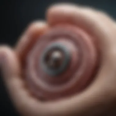 Techniques in Aortic Valve Replacement Surgical techniques for aortic valve replacement