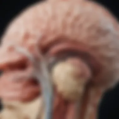 Anatomical Overview of Thalamic Gliomas Illustration depicting the anatomical location of thalamic gliomas in the brain