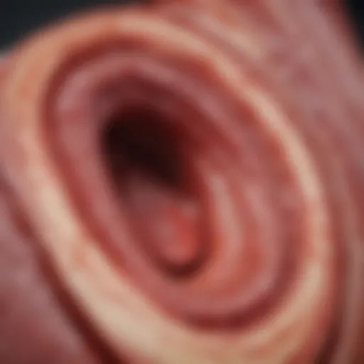 Illustration depicting the arterial plaque buildup associated with atherosclerosis