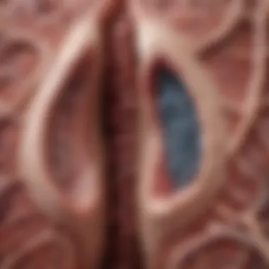Lung Interstitium and ILD Illustration depicting the lung interstitium affected by interstitial lung disease
