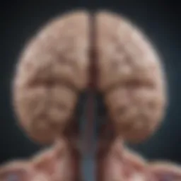 A brain diagram highlighting areas affected by stroke