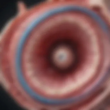 Ovarian Anatomy and Psammomacarcinoma Anatomical diagram of the ovary highlighting psammomacarcinoma