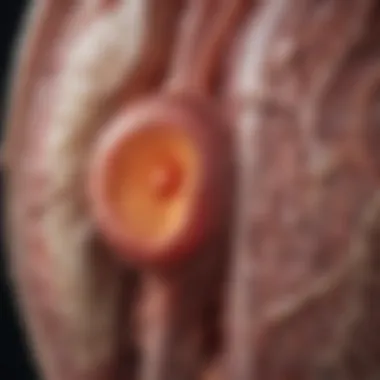 Cyst Formation in Polycystic Kidney Disease Detailed illustration of cyst formation in kidneys affected by PKD