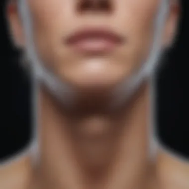 Treatment Options for Thyroid Cysts Chart illustrating treatment options for thyroid cysts