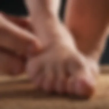 Lifestyle Factors and Gout Lifestyle factors influencing gout and tophi formation