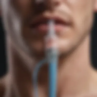 Visual Representation of a Blocked Gastrostomy Tube Gastrostomy tube with blockage